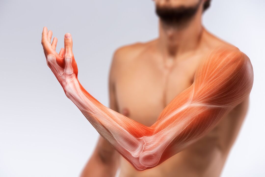 Muscoli manuali e il suo trattamento con trattamento gel Congelum