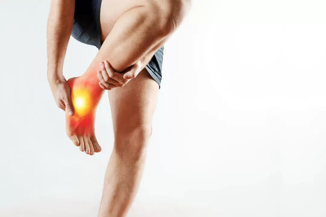articolazione articolare e il suo trattamento con gel Congelum