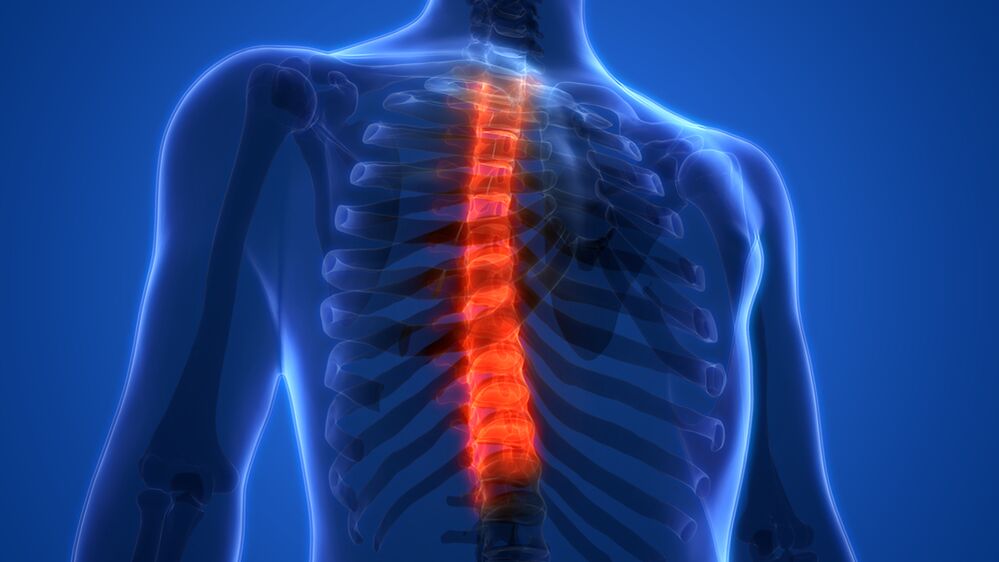 osteocondrosi della colonna vertebrale toracica