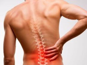 lombalgia dovuta all'osteocondrosi